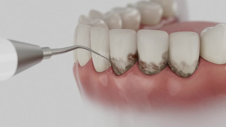 Reliable Dental contractor in Coshocton, OH by Dentist Open Now